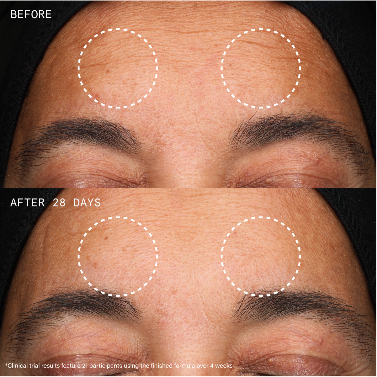 YouthBomb Extreme Retinal Triple Renewal Serum B&A