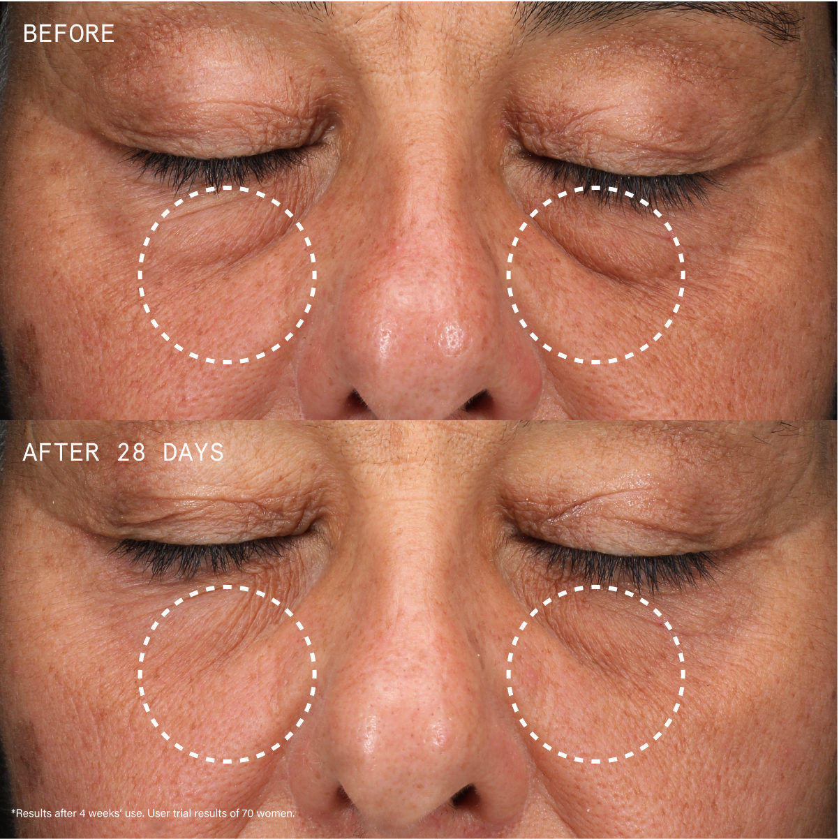 Super Healthy Skin Uber Youth Eye Cream B&A